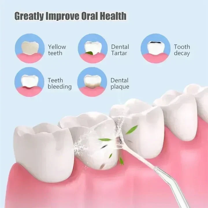 Rechargeable Water Flosser with Interchangeable Nozzles - Portable Dental Care Solution for Effective Oral Hygiene