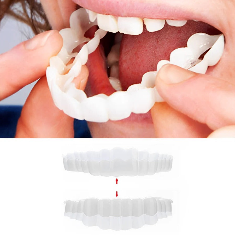 Complete Dental Veneer Kit - Upper & Lower Cosmetic Teeth Covers for a Perfect Smile