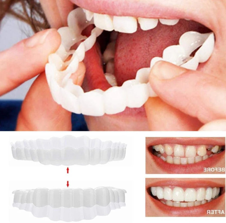 Complete Dental Veneer Kit - Upper & Lower Cosmetic Teeth Covers for a Perfect Smile