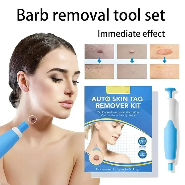 Skin Tag Removal Kit - Complete Set with Silicone Bands & Precision Pen Tool for Safe & Easy Removal