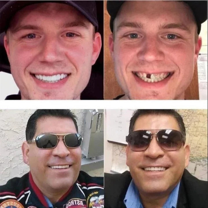 Adjustable Cosmetic Smile Veneers Set - Upper & Lower Teeth - Perfect Fit for a Beautiful Smile