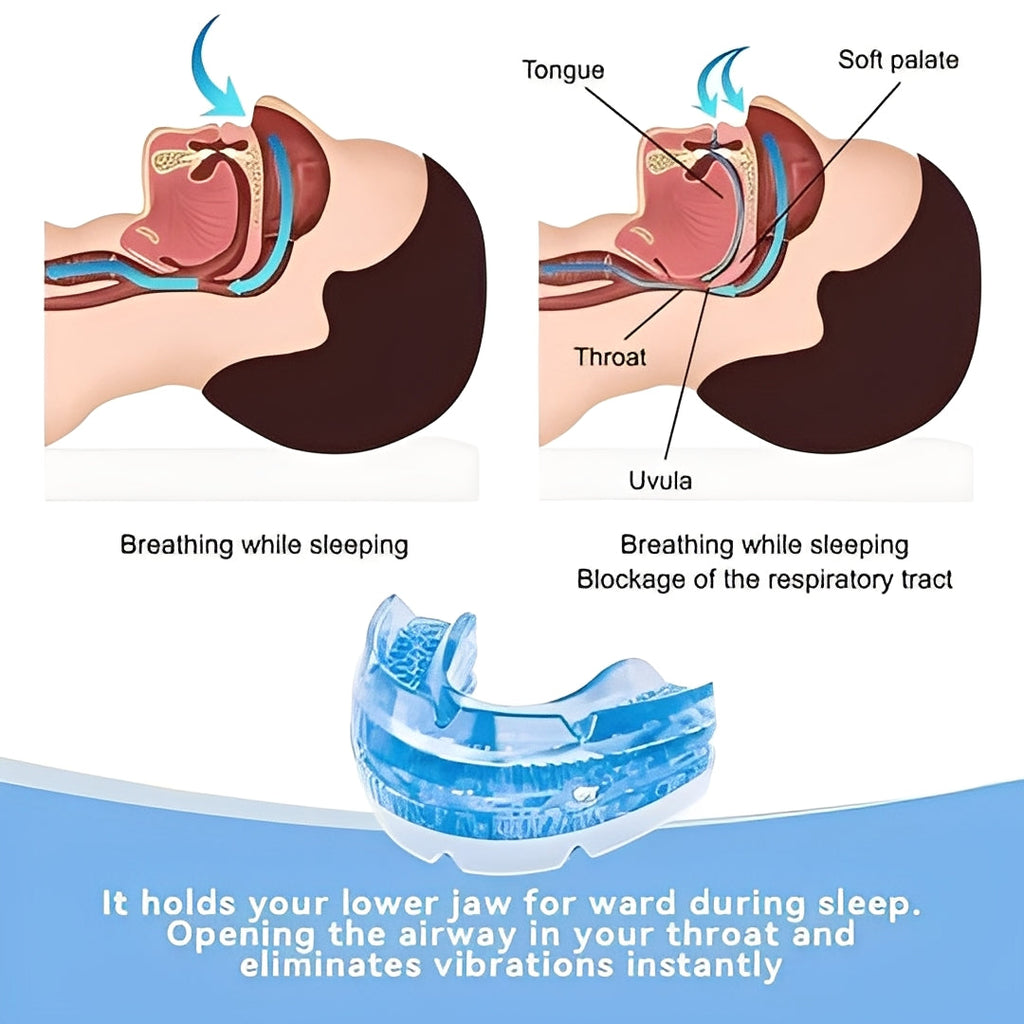 Customizable Adjustable Mouthpiece with Screw Fit for Comfortable Nighttime Sleep