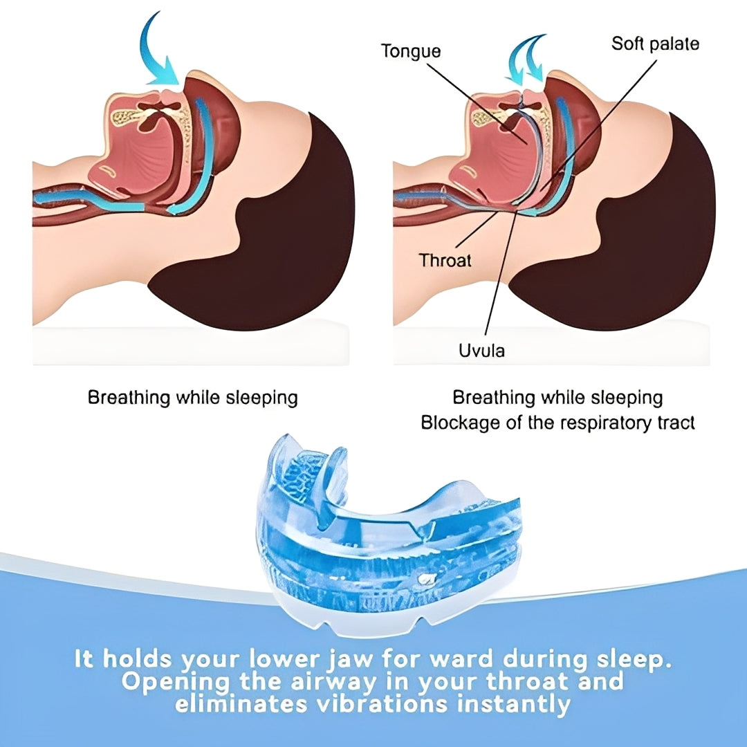 Customizable Adjustable Mouthpiece with Screw Fit for Comfortable Nighttime Sleep