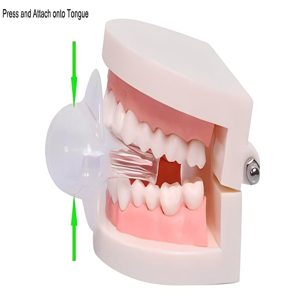 Tongue Positioning Device for Enhanced Sleep Airflow Support - Comfortable Sleep Aid for Snoring Relief