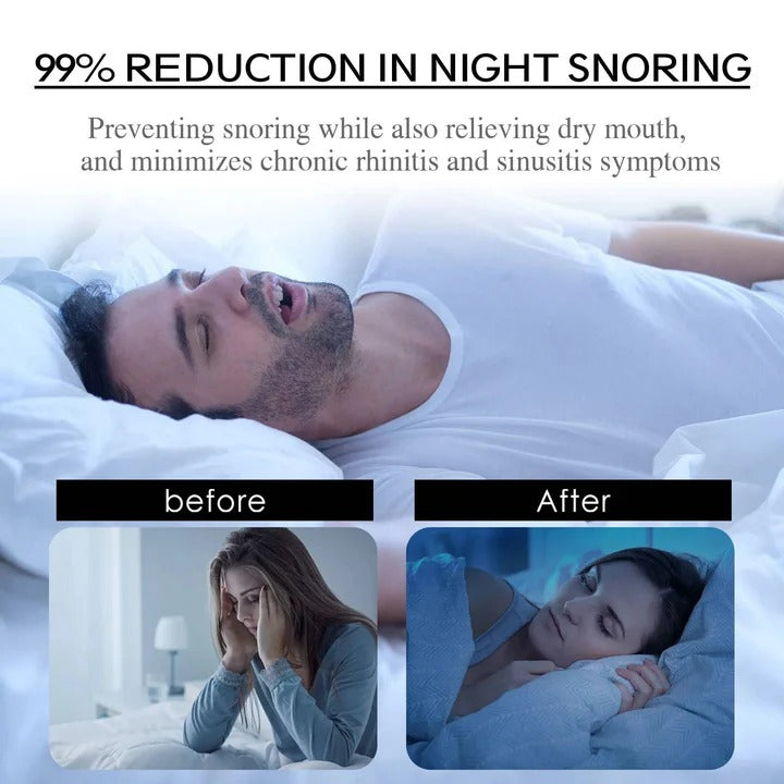 Sleep Mouth Tape for Enhanced Nasal Breathing Support | Comfortable & Hypoallergenic Sleep Aid
