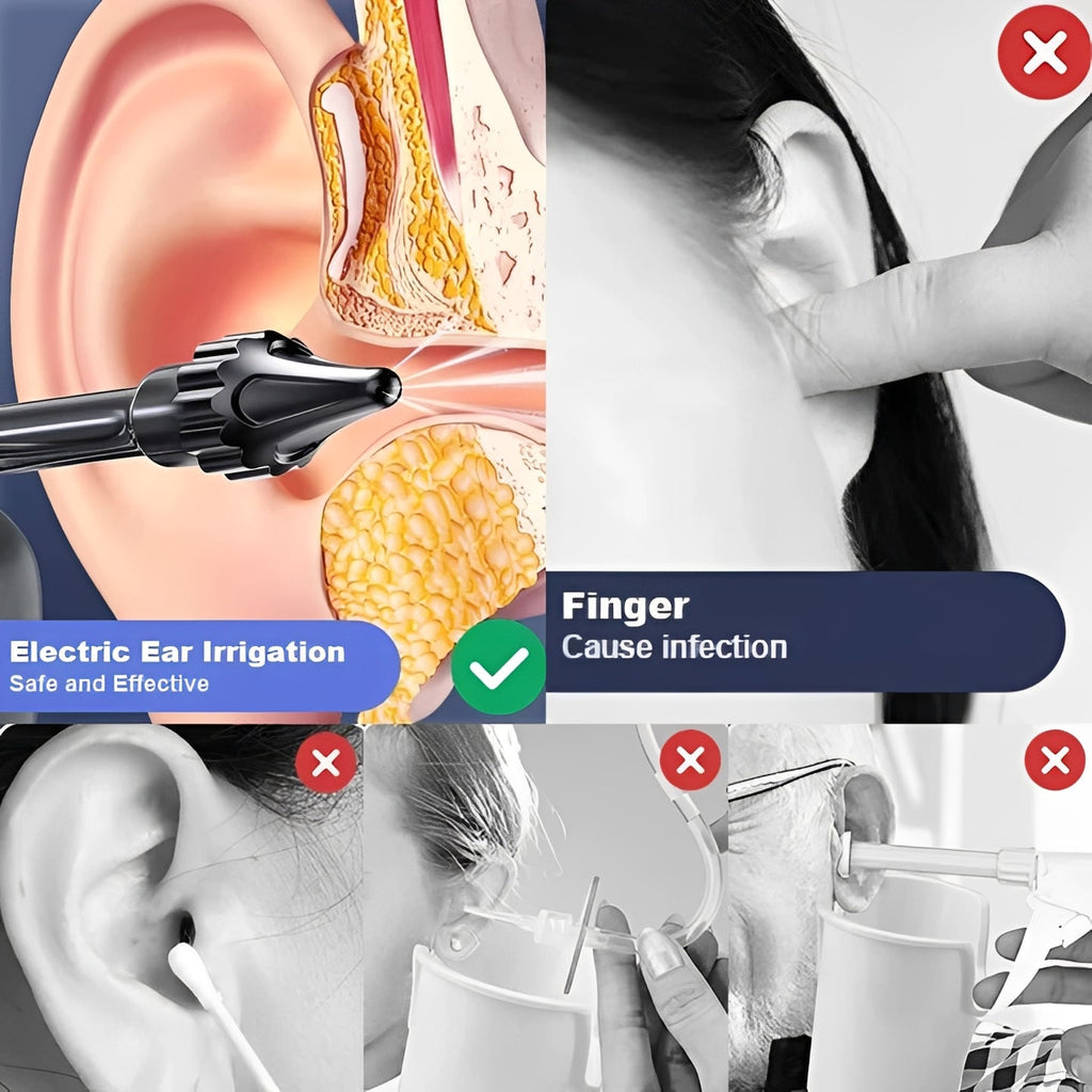 USB Rechargeable Water-Based Ear Rinsing Device for Safe and Effective Ear Cleaning