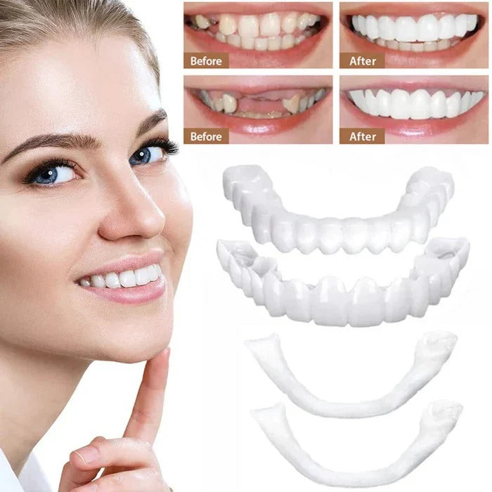 Clip-On Cosmetic Veneers & Temporary Tooth Covers for Instant Smile Makeover | Easy Fit, Natural Look