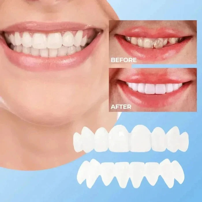 Clip-On Cosmetic Veneers & Temporary Tooth Covers for Instant Smile Makeover | Easy Fit, Natural Look