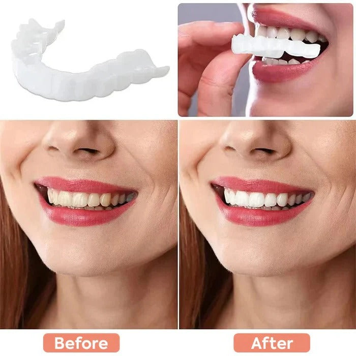 Clip-On Cosmetic Veneers & Temporary Tooth Covers for Instant Smile Makeover | Easy Fit, Natural Look