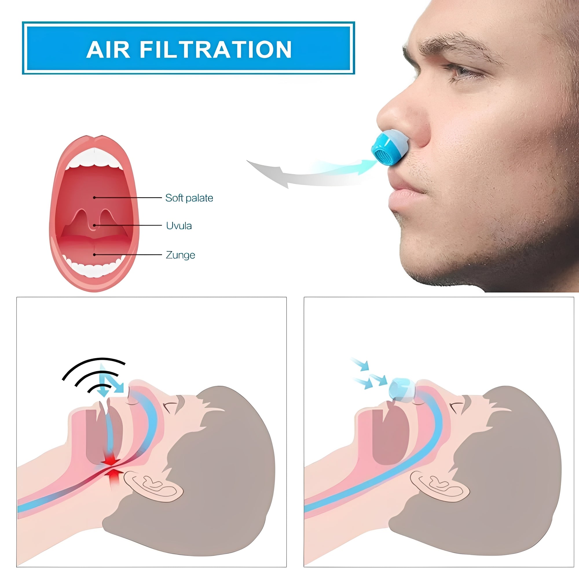 Cordless Nasal Sleep Aid Device - Compact Snoring Relief Insert for Better Sleep