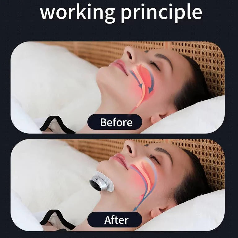 Smart Snoring Support Device with Automatic Stimulation Adjustment for Better Sleep Quality