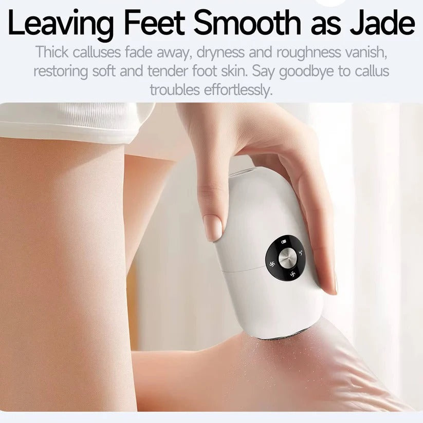 Rechargeable Electric Foot File with Adjustable Speed - Professional Callus Remover for Smooth Feet
