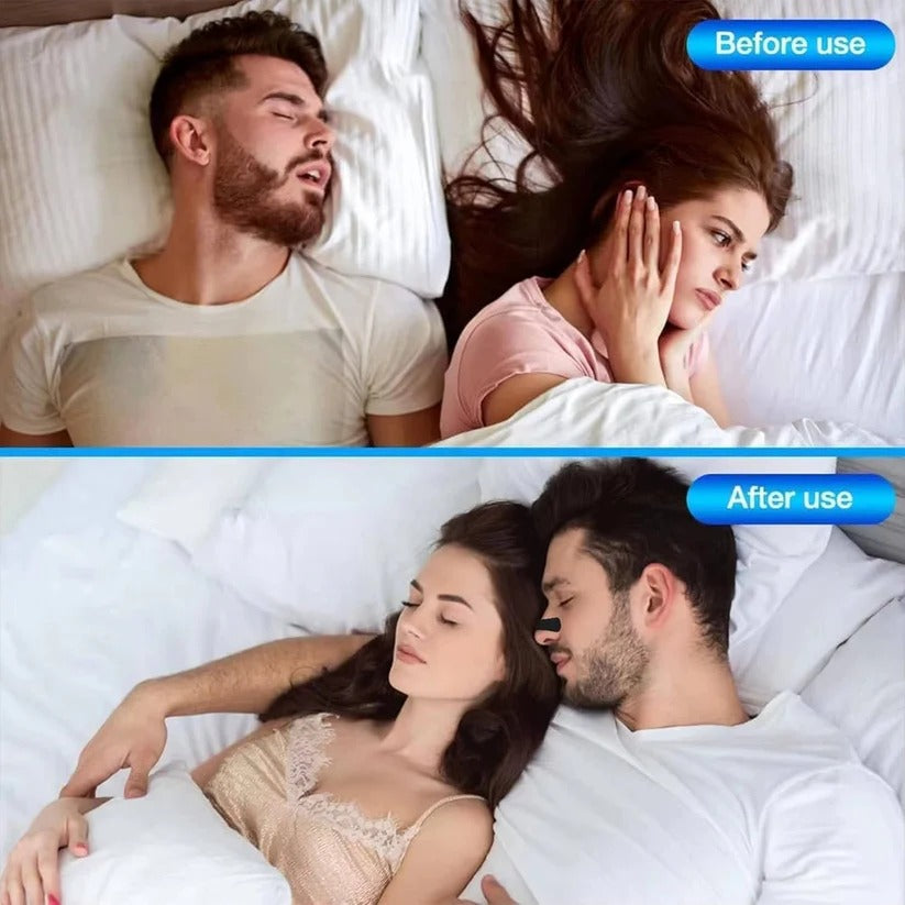 Triple Layer Nasal Strips for Enhanced Nighttime Breathing Support - Comfortable, Effective Sleep Aid