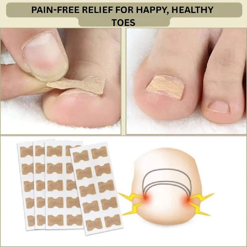 Curved Nail Adhesive Support Strips - Daily Nail Care Solution for Stronger, Healthier Nails