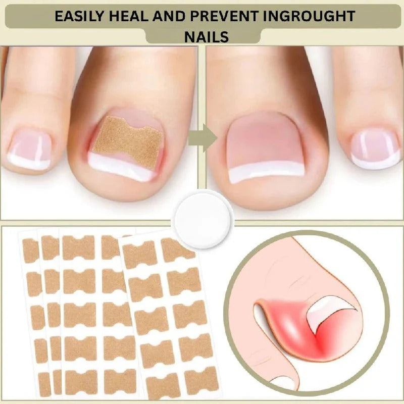 Curved Nail Adhesive Support Strips - Daily Nail Care Solution for Stronger, Healthier Nails