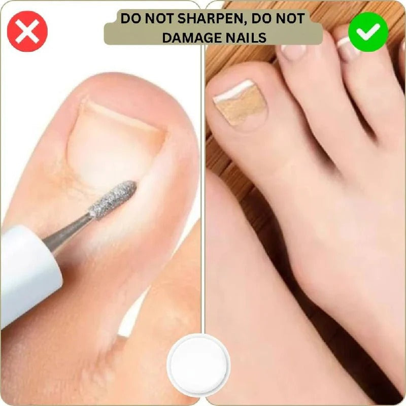 Curved Nail Adhesive Support Strips - Daily Nail Care Solution for Stronger, Healthier Nails