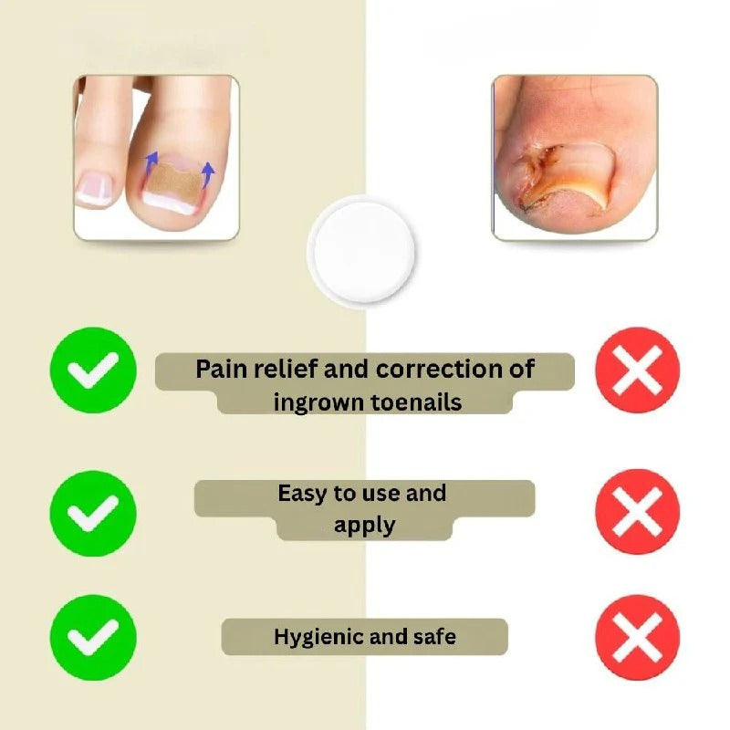 Curved Nail Adhesive Support Strips - Daily Nail Care Solution for Stronger, Healthier Nails