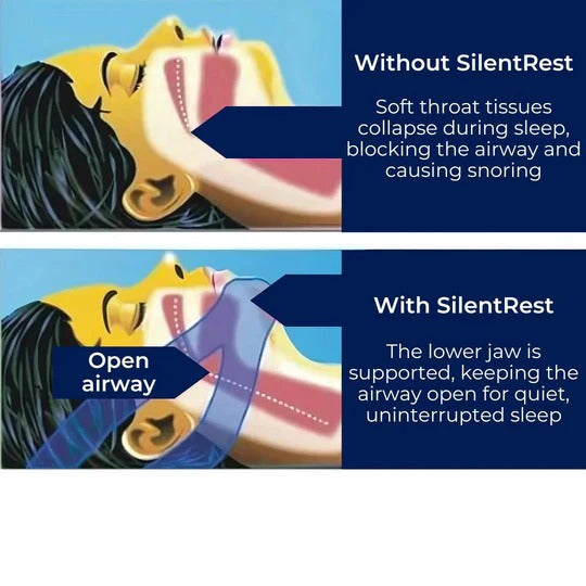 Anti-Snore Chin Strap for Sleep Support - Adjustable, Comfortable Sleep Aid for Better Rest