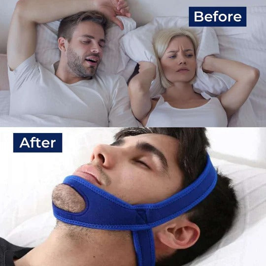 Anti-Snore Chin Strap for Sleep Support - Adjustable, Comfortable Sleep Aid for Better Rest