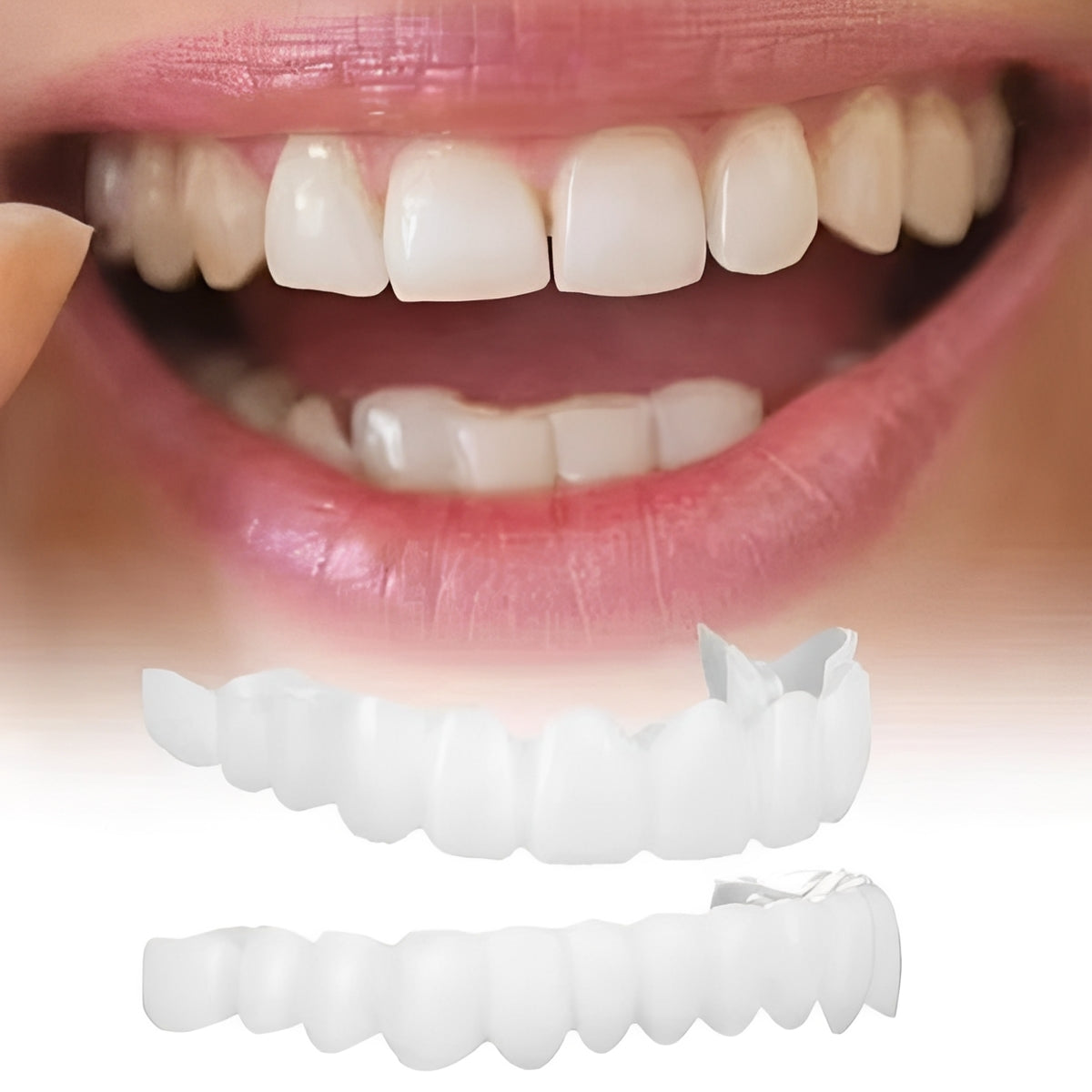 Snap-On Cosmetic Tooth Covers for Adults - 2-Piece Set for Instant Smile Makeover