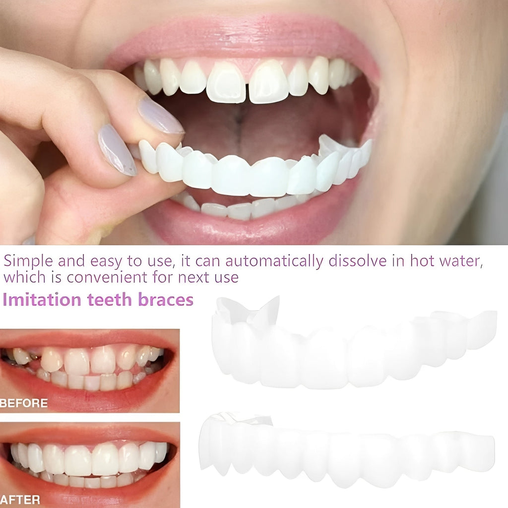 Snap-On Cosmetic Tooth Covers for Adults - 2-Piece Set for Instant Smile Makeover