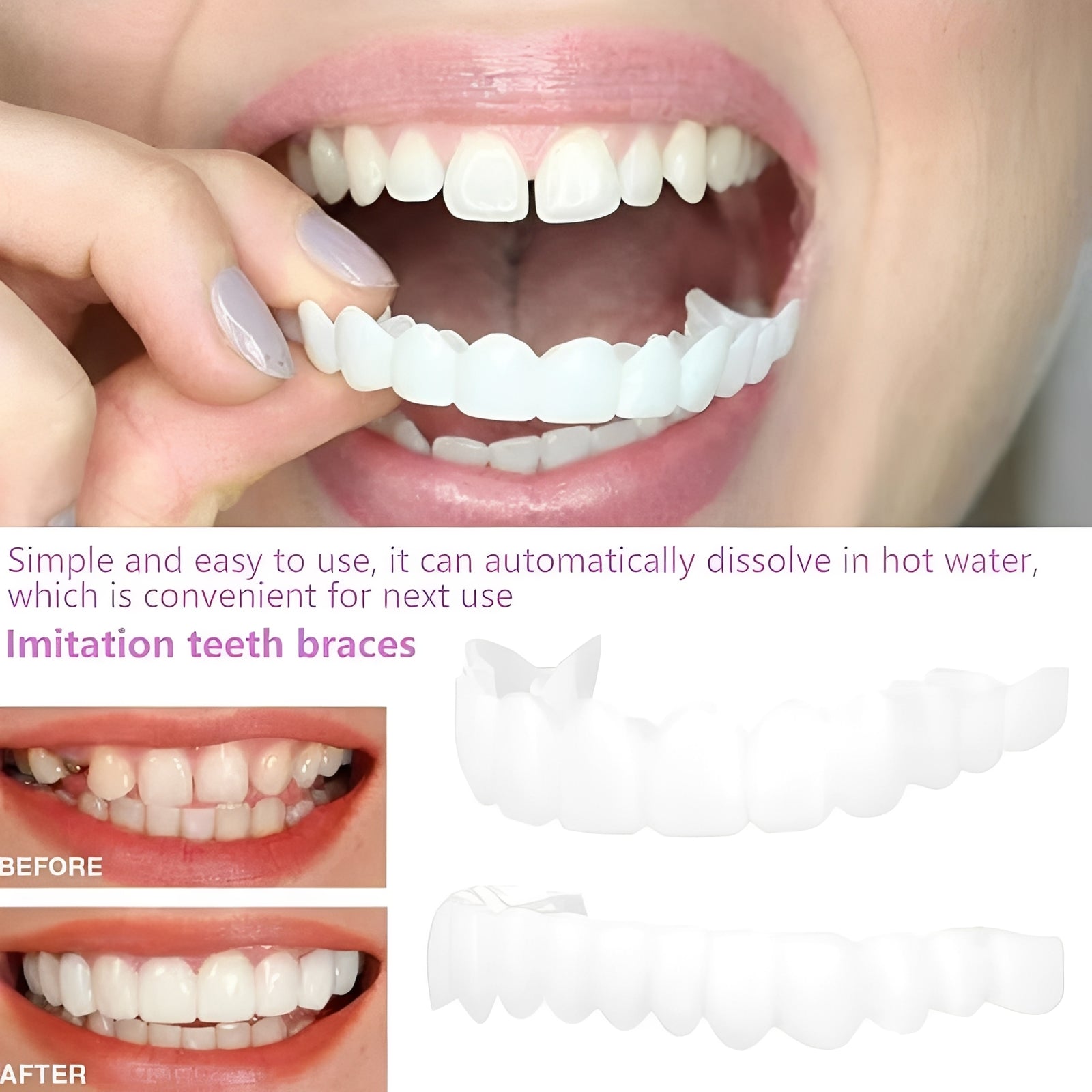 Snap-On Cosmetic Tooth Covers for Adults - 2-Piece Set for Instant Smile Makeover
