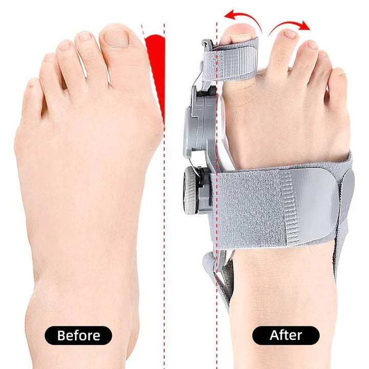 Adjustable Toe Spacer for Optimal Foot Alignment & Comfort Support