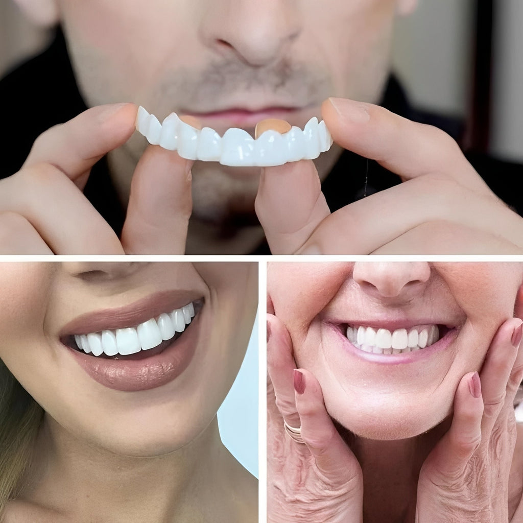 Snap-On Cosmetic Tooth Covers for Adults - 2-Piece Set for Instant Smile Makeover