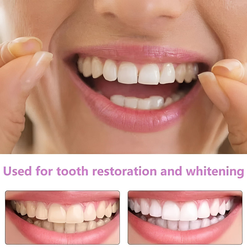 Snap-On Cosmetic Tooth Covers for Adults - 2-Piece Set for Instant Smile Makeover