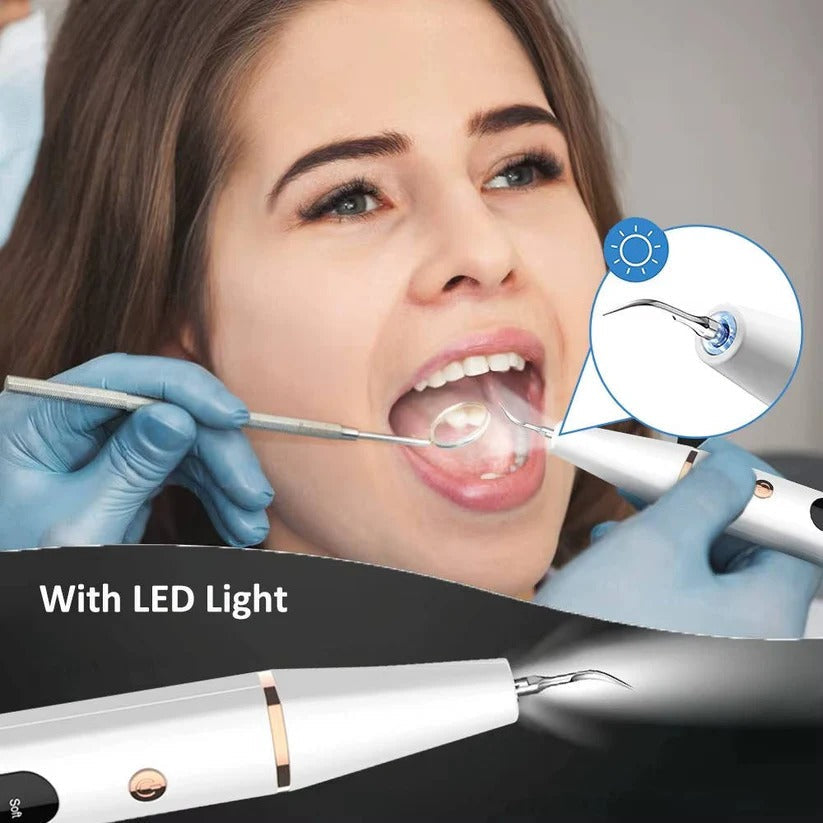 USB Rechargeable Dental Cleaning Kit with LED Light - Portable Oral Hygiene Tool for Teeth Whitening & Plaque Removal
